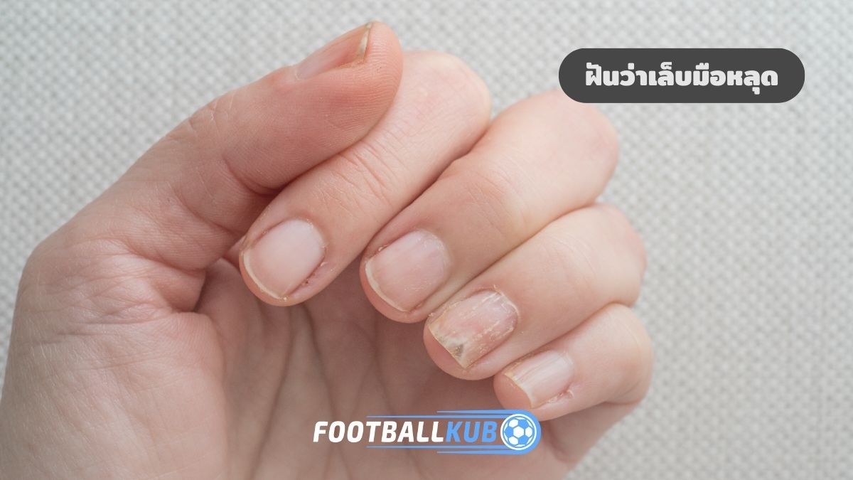 ฝันว่าเล็บมือหลุด